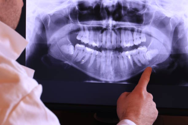 Best Urgent Care for Lost Fillings or Crowns in Scaggsville, MD